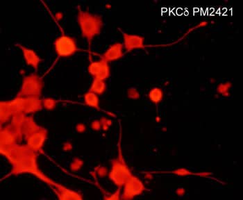 PKC delta Antibody (M242)