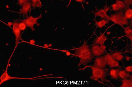 PKC theta Antibody (M217)