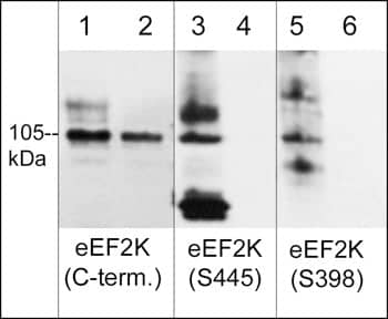 EEF2K [p Ser398] Antibody