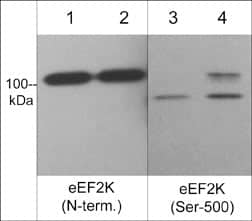 EEF2K [p Ser500] Antibody