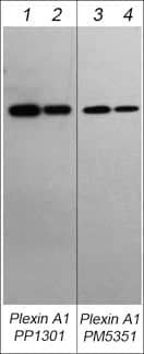 Plexin A1 Antibody (M535)