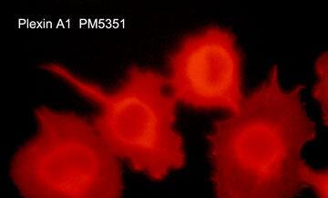 Plexin A1 Antibody (M535)