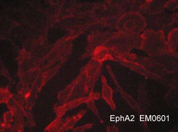 EphA2 Antibody (M060)