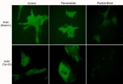 beta-Actin [p Tyr53] Antibody