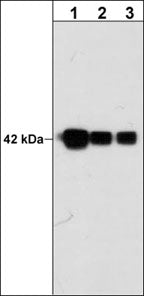 beta-Actin Antibody (M202)