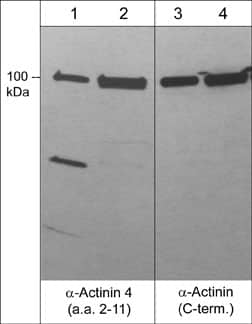 Alpha Actinin 4 Antibody