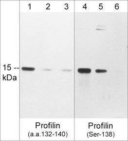 Profilin 1 Antibody