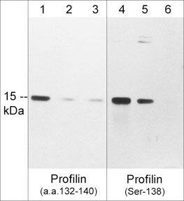 Profilin 1 [p Ser138] Antibody