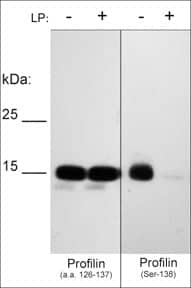 Profilin 1 [p Ser138] Antibody