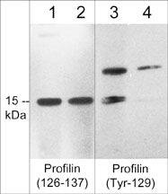 Profilin 1 Antibody