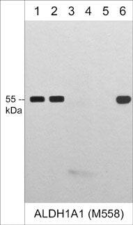 Aldehyde Dehydrogenase 1-A1/ALDH1A1 Antibody (M558)