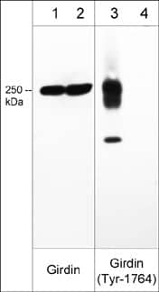 Girdin Antibody (M012)