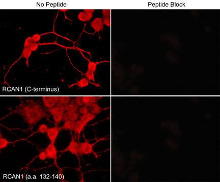RCAN1 Antibody