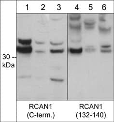 RCAN1 Antibody