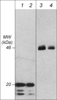 GSK-3 beta Antibody (M131)