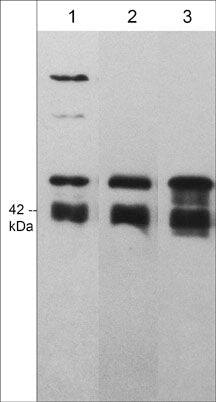 ACTR3 Antibody