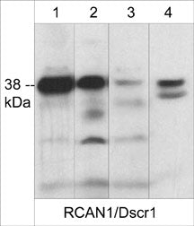 RCAN1 Antibody