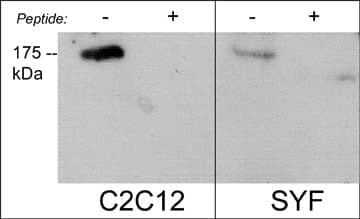 ROBO2 Antibody