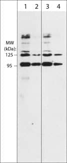 Semaphorin 3A Antibody (M317)