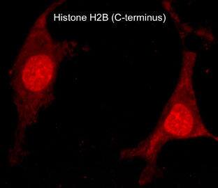 Histone H2B type 1B Antibody