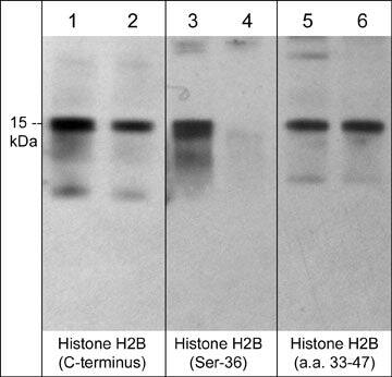 Histone H2B type 1B Antibody