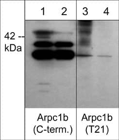 actin-related protein 2/3 complex subunit 1B [p Thr21] Antibody