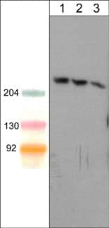 SHANK1 Antibody (M369)