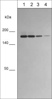 Integrin alpha L/CD11a Antibody (M594)