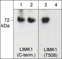 LIM Kinase 1 Antibody