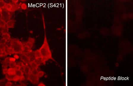 MeCP2 [p Ser421] Antibody