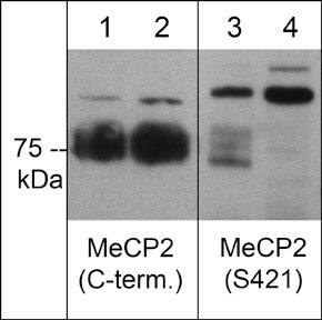 MeCP2 [p Ser421] Antibody