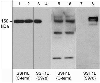 SSH1 Antibody