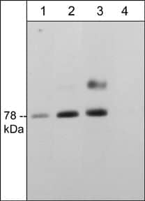 SMPD3/NSMase2 Antibody