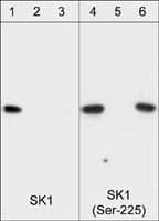 Sphingosine Kinase 1/SPHK1 Antibody