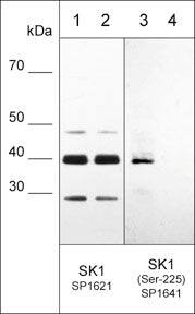 Sphingosine Kinase 1/SPHK1 Antibody