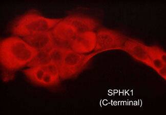 Sphingosine Kinase 1/SPHK1 Antibody (M540)