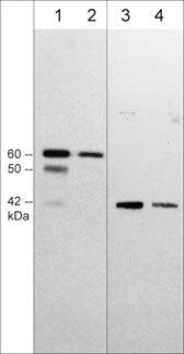 Sphingosine Kinase 1/SPHK1 Antibody (M540)