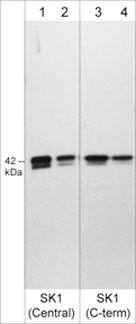 Sphingosine Kinase 1/SPHK1 Antibody