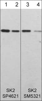 Sphingosine Kinase 2/SPHK2 Antibody (M532)