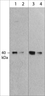 MuRF1/TRIM63 Antibody (M316)