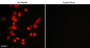 MuRF1/TRIM63 Antibody