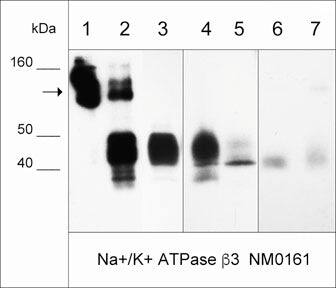 ATPase Na+/K+ beta 3 Antibody (M016)