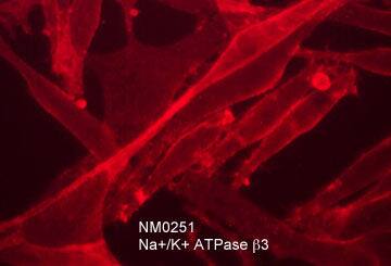 ATPase Na+/K+ beta 3 Antibody (M025)