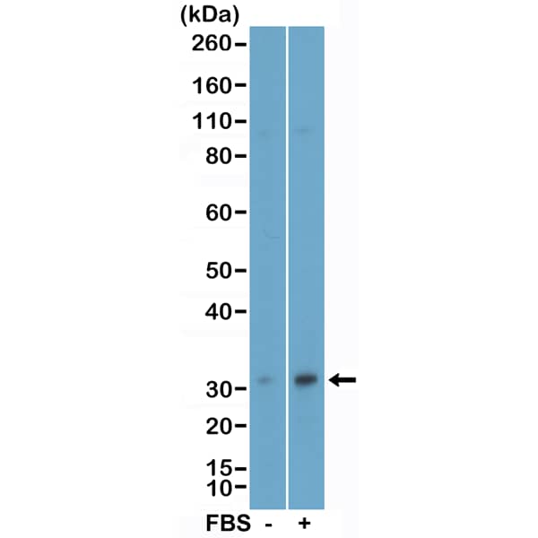 eIF4E Antibody (RM452)