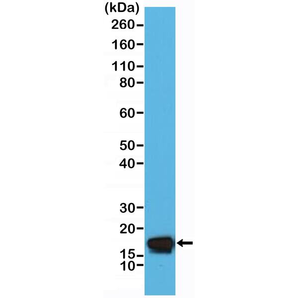 Stathmin 1 Antibody (RM350)