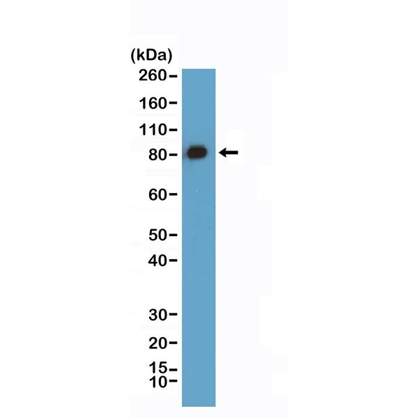 Caldesmon/CALD1 Antibody (RM396)