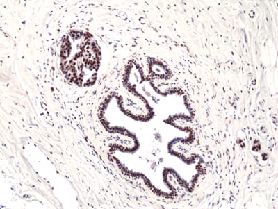 FoxP1 Antibody (RM402)