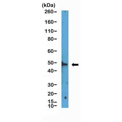 HDAC3 Antibody (RM439)