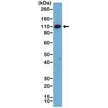 MSH2 Antibody (RM478)