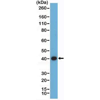 ERK2 Antibody (RM483)